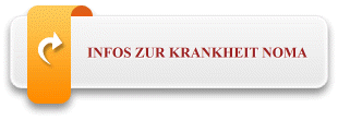 Was ist Noma?