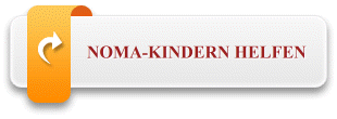 Noma-Kindern helfen